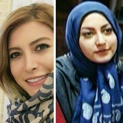 تغییر خانم بازیگر بعد از جراحی بینی!/عکس
